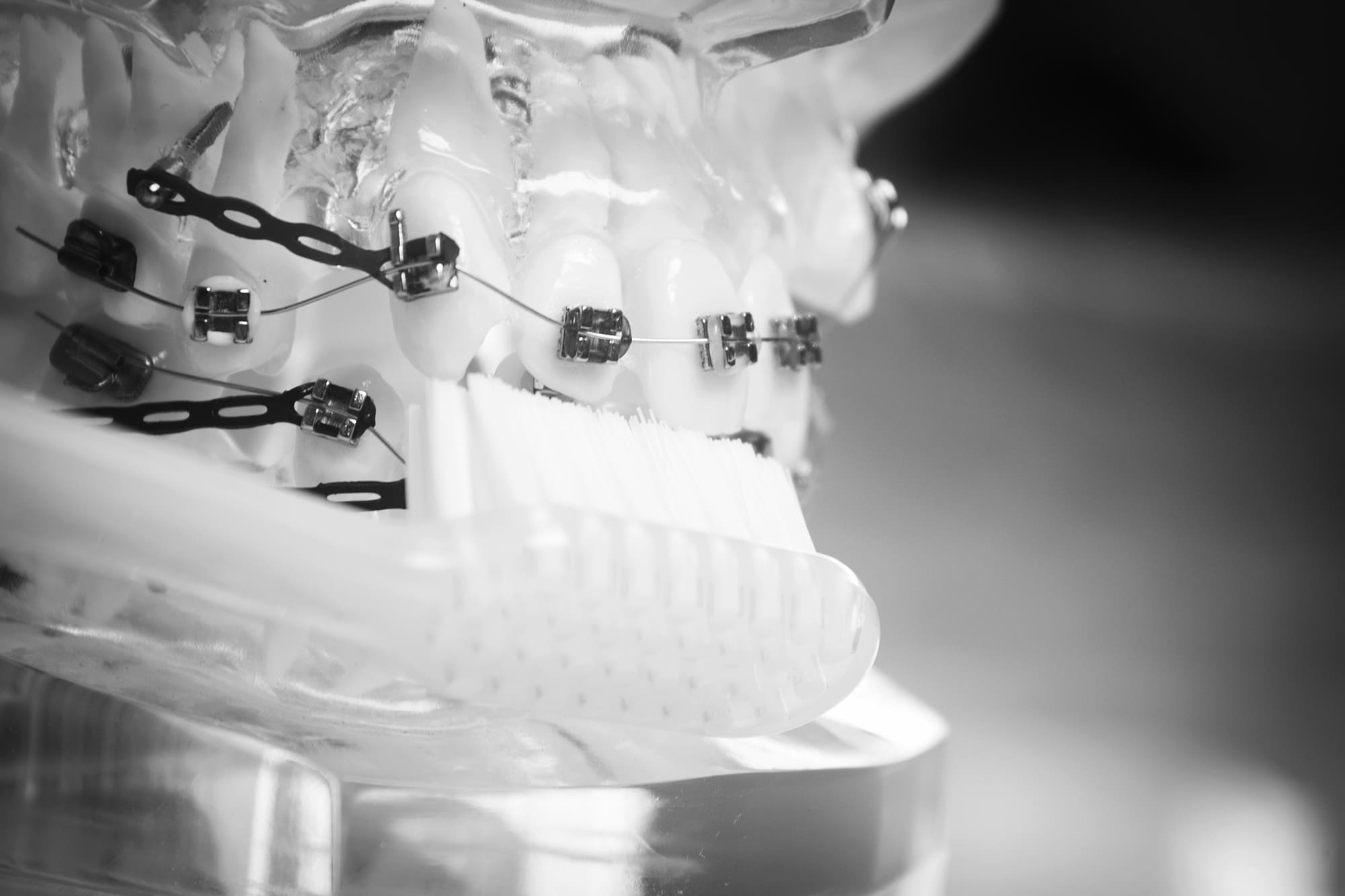 Ορθοδοντική